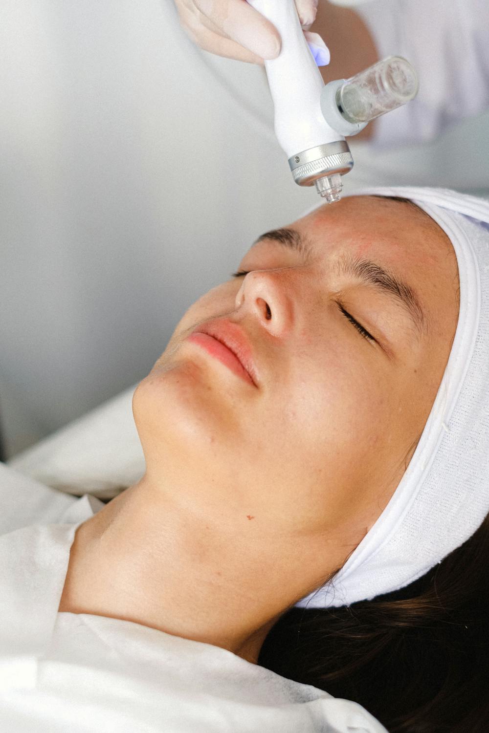Micro-Peel